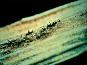 détail des acervules